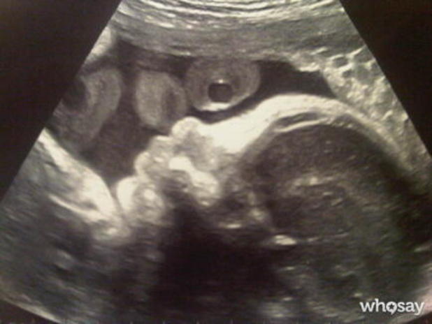 Shakira and Gerard Pique share ultrasound photo on Twitter. 